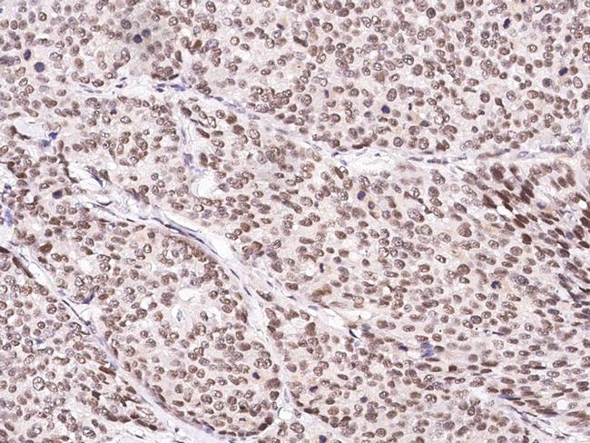 CUEDC2 Antibody in Immunohistochemistry (Paraffin) (IHC (P))