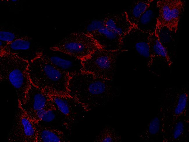 CAR Antibody in Immunocytochemistry (ICC/IF)