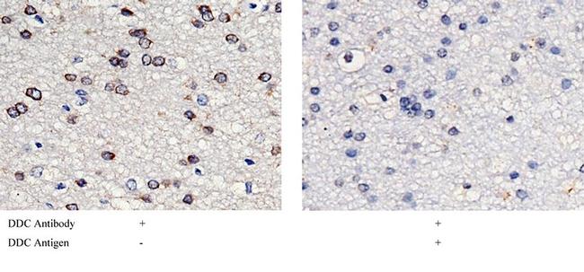 DOPA Decarboxylase Antibody in Immunohistochemistry (Paraffin) (IHC (P))