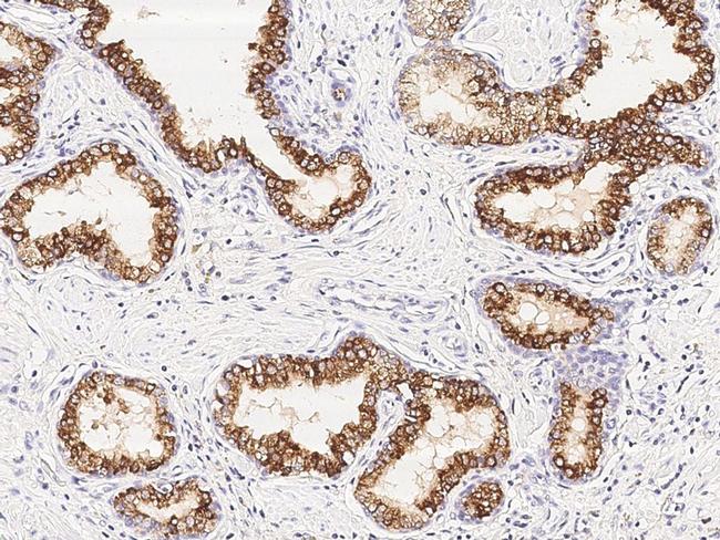 ENTPD5 Antibody in Immunohistochemistry (Paraffin) (IHC (P))