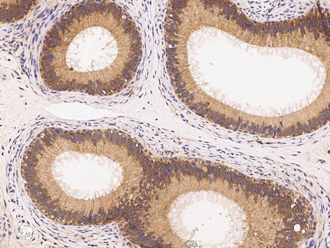 IRE1 alpha Antibody in Immunohistochemistry (Paraffin) (IHC (P))