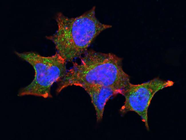 GBA3 Antibody in Immunocytochemistry (ICC/IF)