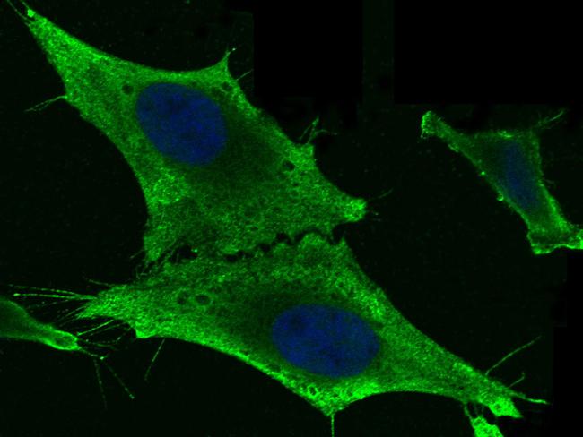 GSTM2 Antibody in Immunocytochemistry (ICC/IF)