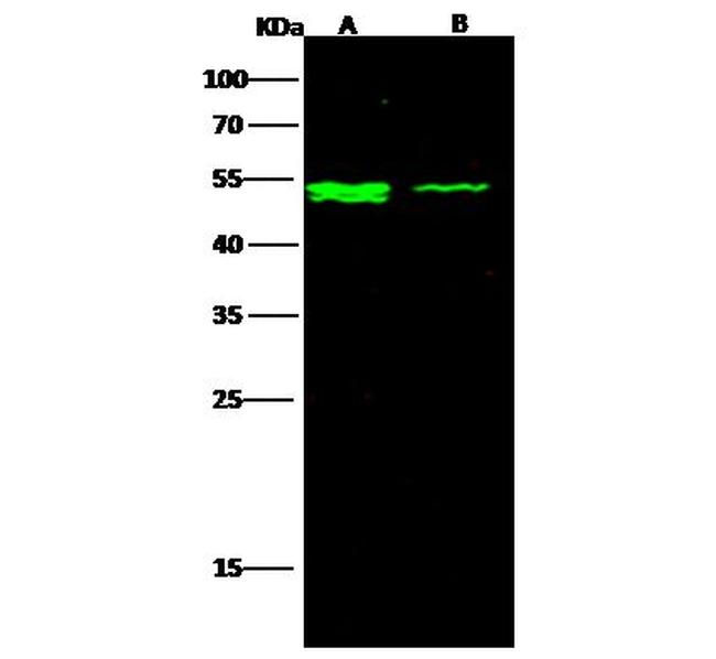 IFNAR2 Antibody in Western Blot (WB)