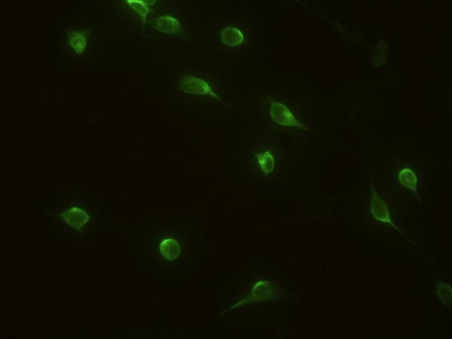 IL1RA Antibody in Immunocytochemistry (ICC/IF)