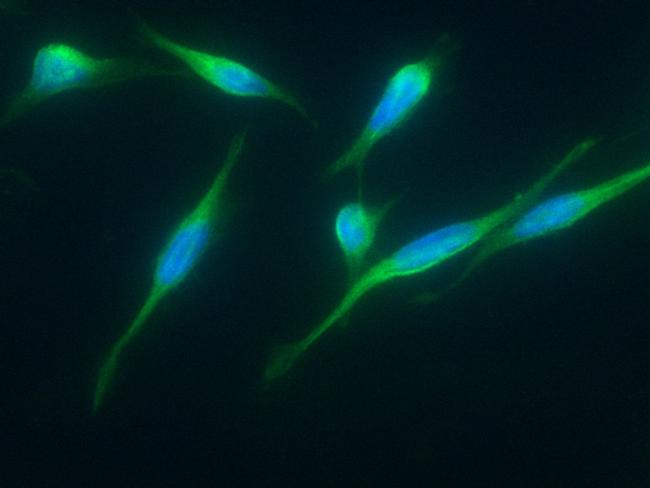 ITCH Antibody in Immunocytochemistry (ICC/IF)