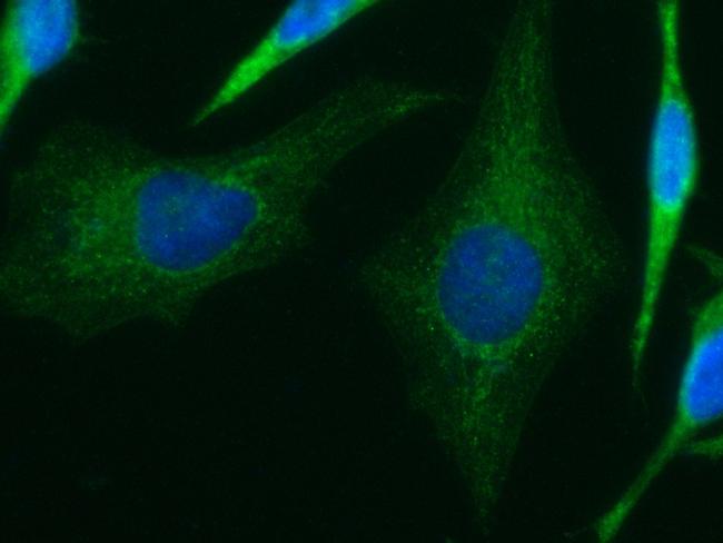 IVD Antibody in Immunocytochemistry (ICC/IF)