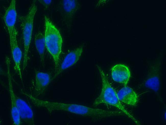 CD171 Antibody in Immunocytochemistry (ICC/IF)