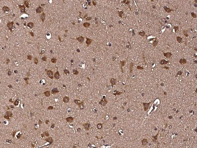 RAP Antibody in Immunohistochemistry (Paraffin) (IHC (P))