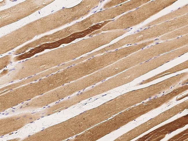 MAPKAPK3 Antibody in Immunohistochemistry (Paraffin) (IHC (P))