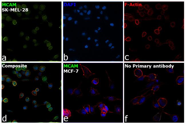 CD146 Antibody in Immunocytochemistry (ICC/IF)