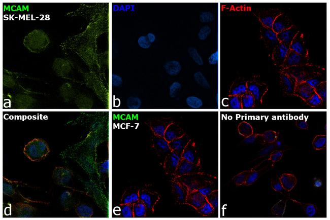 CD146 Antibody in Immunocytochemistry (ICC/IF)