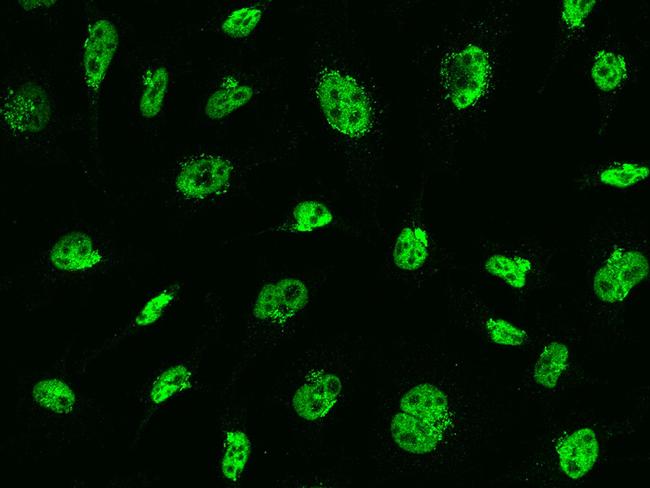 MSH6 Antibody in Immunocytochemistry (ICC/IF)