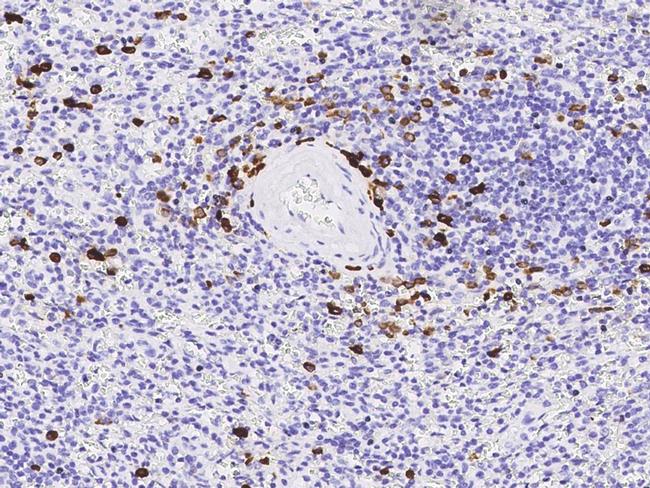 MZB1 Antibody in Immunohistochemistry (Paraffin) (IHC (P))