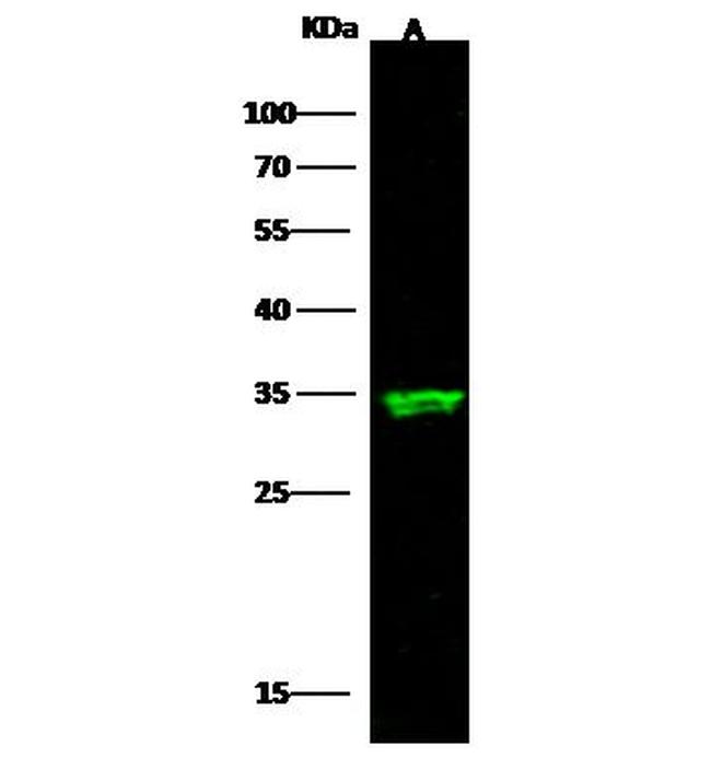 ARD1A Antibody in Western Blot (WB)