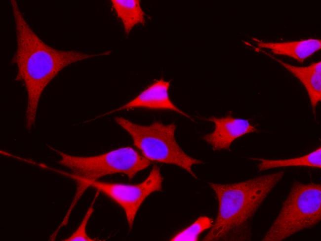 NME1 Antibody in Immunocytochemistry (ICC/IF)