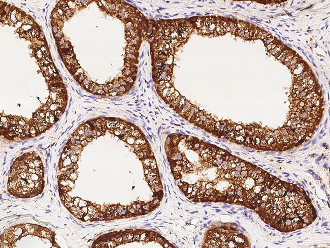 NPC2 Antibody in Immunohistochemistry (Paraffin) (IHC (P))