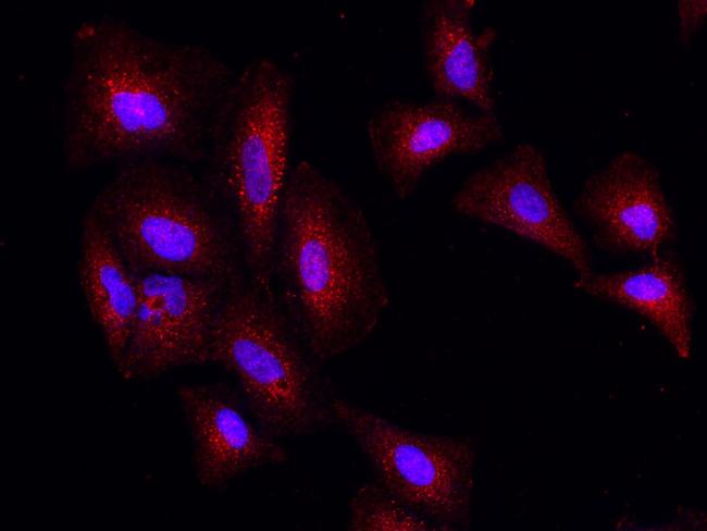 PSPH Antibody in Immunocytochemistry (ICC/IF)