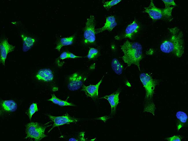 RhoA Antibody in Immunocytochemistry (ICC/IF)