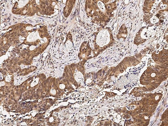 RUVBL1 Antibody in Immunohistochemistry (Paraffin) (IHC (P))