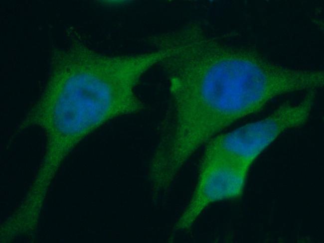 S100A6 Antibody in Immunocytochemistry (ICC/IF)