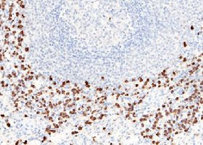 S100A8 Antibody in Immunohistochemistry (Paraffin) (IHC (P))