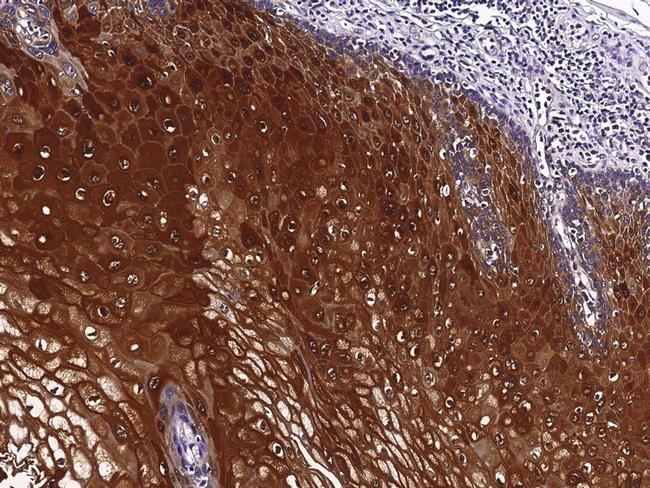 SERPINB4 Antibody in Immunohistochemistry (Paraffin) (IHC (P))