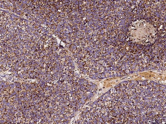 SOD2 Antibody in Immunohistochemistry (Paraffin) (IHC (P))