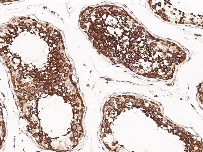 SRPK1 Antibody in Immunohistochemistry (Paraffin) (IHC (P))