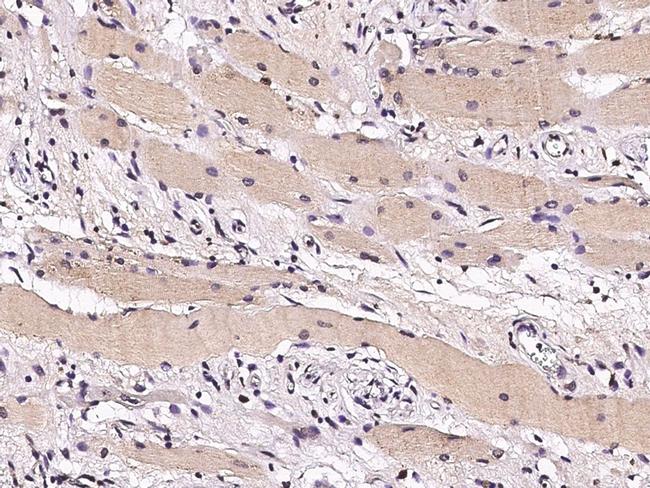 STUB1 Antibody in Immunohistochemistry (Paraffin) (IHC (P))