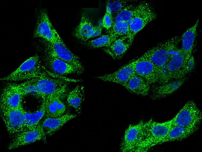 SULT1A1 Antibody in Immunocytochemistry (ICC/IF)