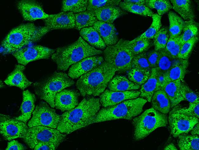 TFPI Antibody in Immunocytochemistry (ICC/IF)