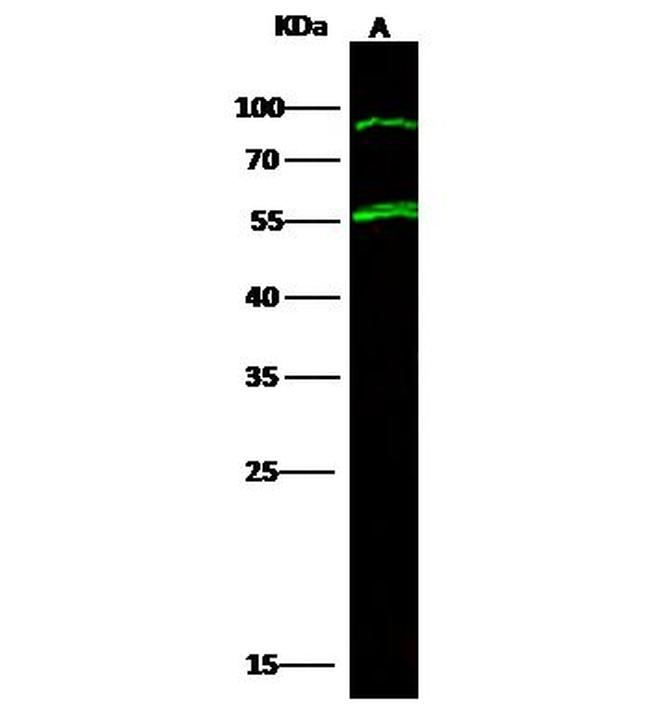 TPH1 Antibody in Western Blot (WB)