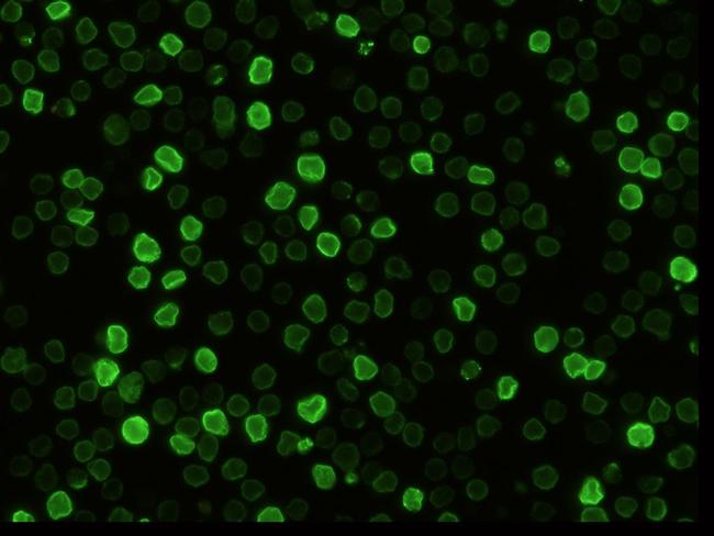 CD147 Antibody in Immunocytochemistry (ICC/IF)