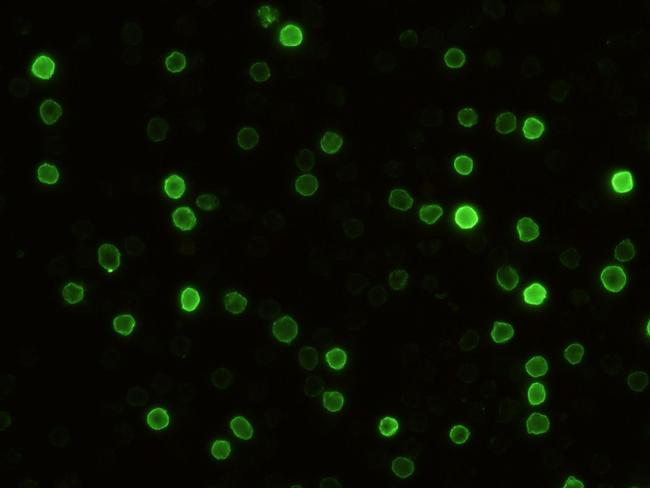 CD5 Antibody in Immunocytochemistry (ICC/IF)