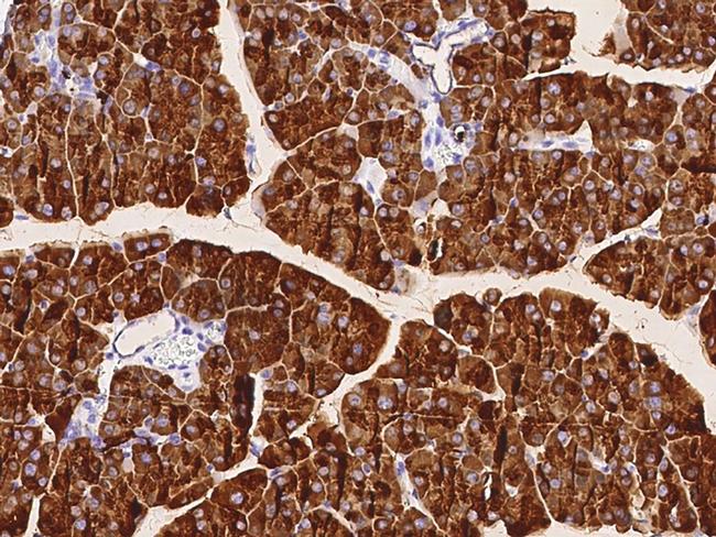 CEL Antibody in Immunohistochemistry (Paraffin) (IHC (P))