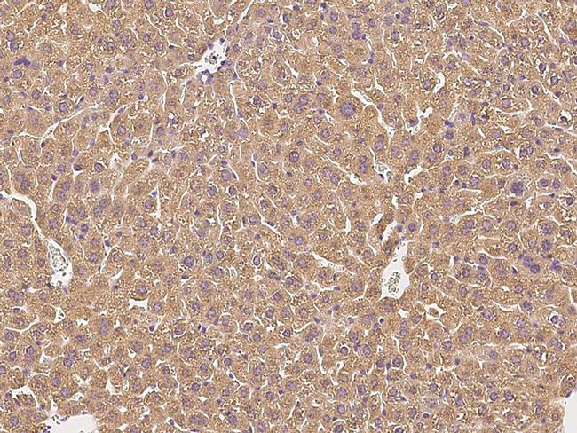 Complement Factor H Antibody in Immunohistochemistry (Paraffin) (IHC (P))