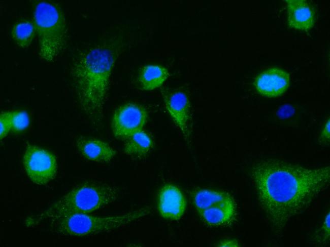 Dectin 1 (soluble) Antibody in Immunocytochemistry (ICC/IF)