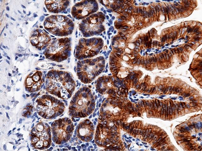 EpCAM Antibody in Immunohistochemistry (Paraffin) (IHC (P))