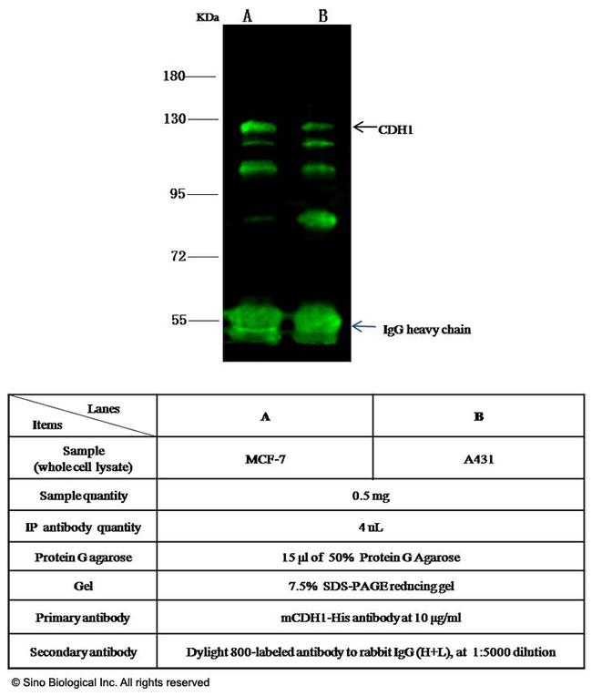 E-cadherin Antibody in Immunoprecipitation (IP)