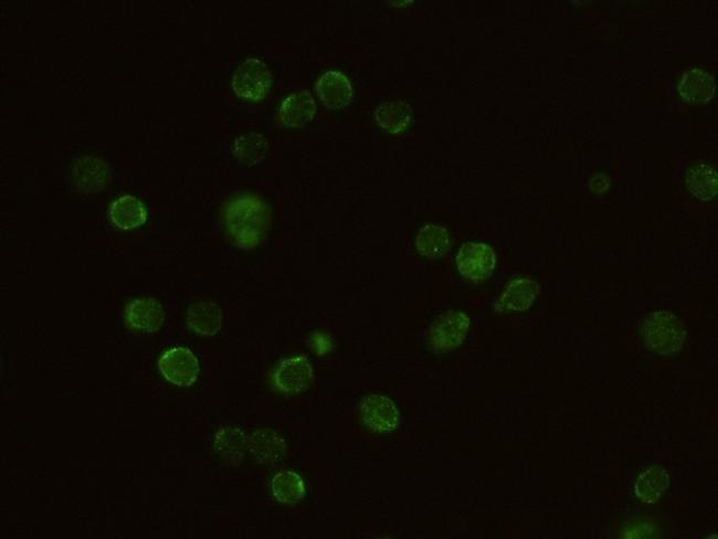 IL2RG Antibody in Immunocytochemistry (ICC/IF)