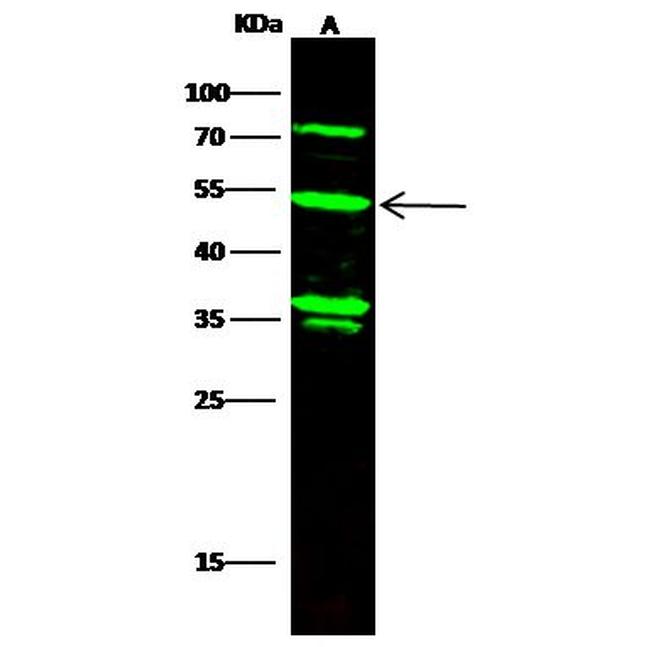 KYNU Antibody in Western Blot (WB)