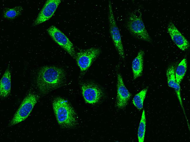 RAP Antibody in Immunocytochemistry (ICC/IF)