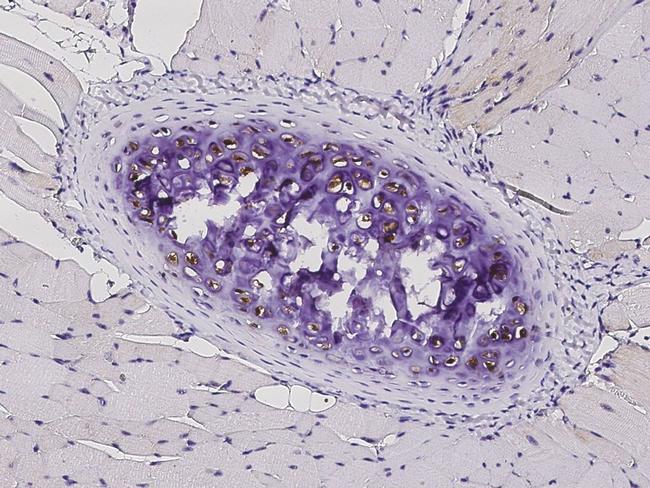 S100A1 Antibody in Immunohistochemistry (Paraffin) (IHC (P))