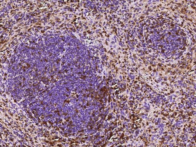 S100A6 Antibody in Immunohistochemistry (Paraffin) (IHC (P))