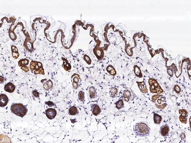 TROP2 Antibody in Immunohistochemistry (Paraffin) (IHC (P))