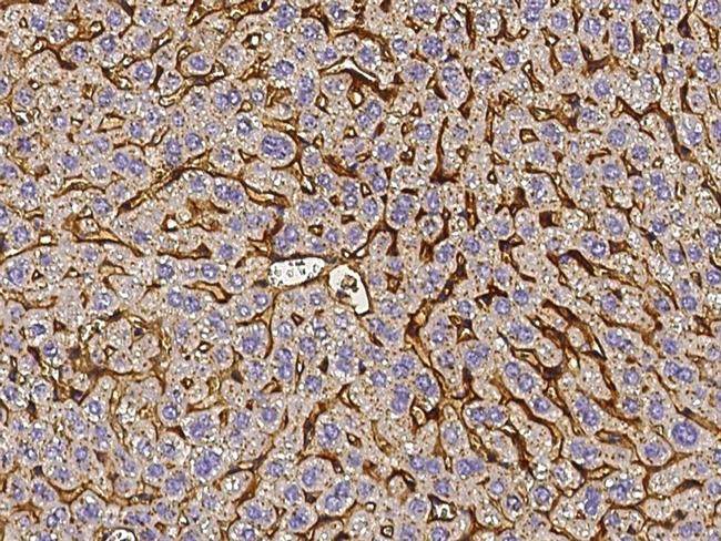 Vitronectin Antibody in Immunohistochemistry (Paraffin) (IHC (P))