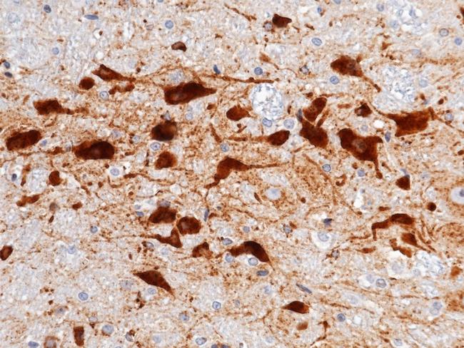 Cystatin C Antibody in Immunohistochemistry (Paraffin) (IHC (P))