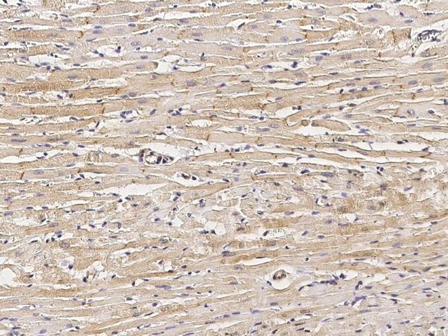 Desmocollin 2 Antibody in Immunohistochemistry (Paraffin) (IHC (P))