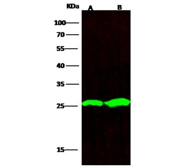 PGP9.5 Antibody in Western Blot (WB)